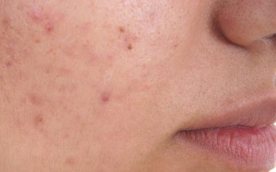 Nutrition & Skin Health