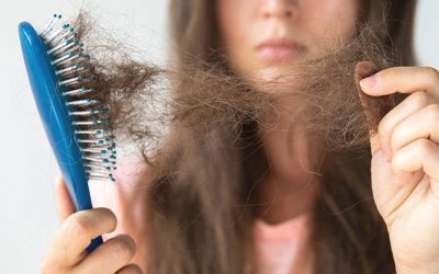Hair Loss and Alopecia